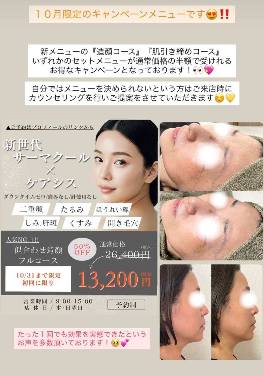 【HIFU】とってもお得なキャンペーンは12月27日まで大幅延長しております♪